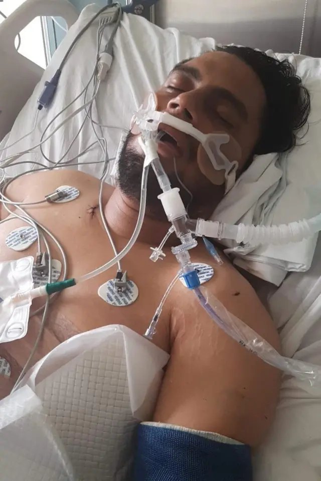 Un hombre hospitalizado, conectado a equipos médicos